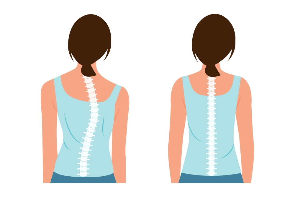 脊椎側彎床墊-脊椎圖